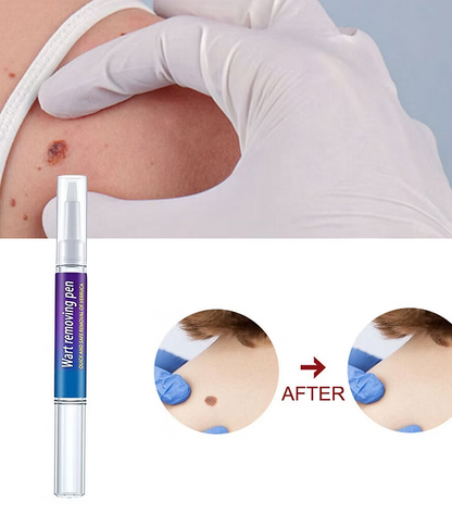 Advanced Herbal Wart Skin Tags Remover