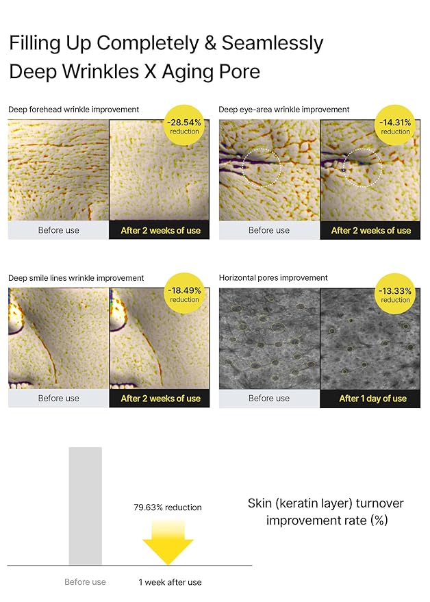 A Retinal Shot Tightening Booster